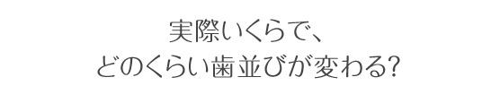 実際いくらで、どのくらい歯並びが変わる?