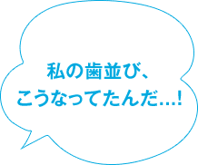 私の歯並び、こうなってたんだ...!